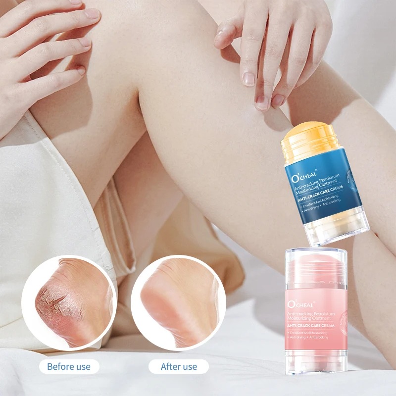 Crema anti-screpolature per pi - Heels recensione e prezzo